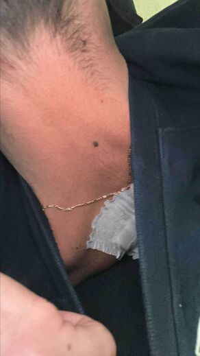 Os ferimentos causados