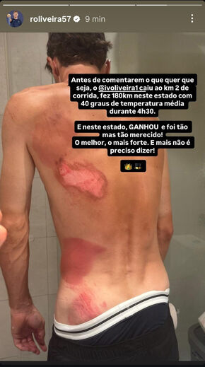 Ivo Oliveira sagra-se campeão nacional de ciclismo após queda feia numa prova