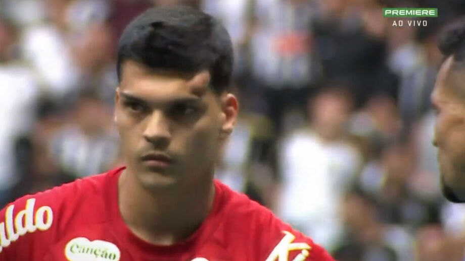 Gabriel Brazão teve de sair do relvado de ambulância