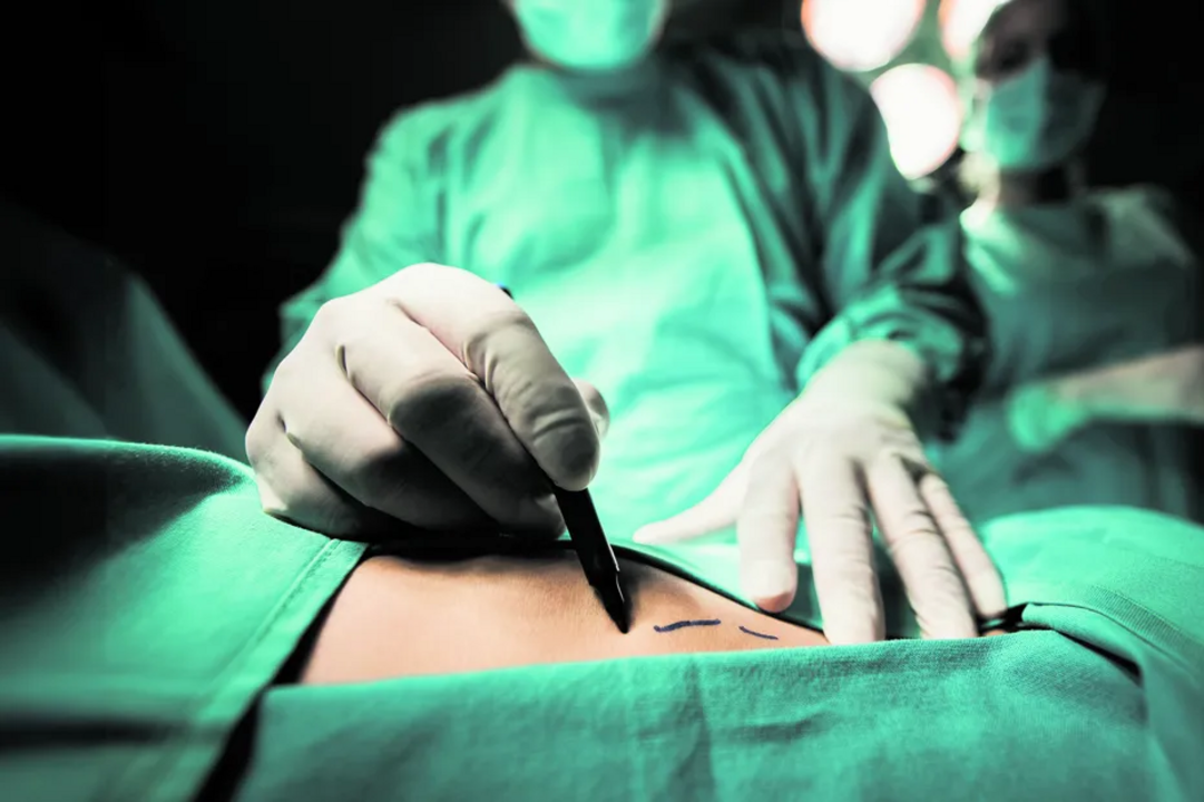Cirurgia realizada em abril de 2019