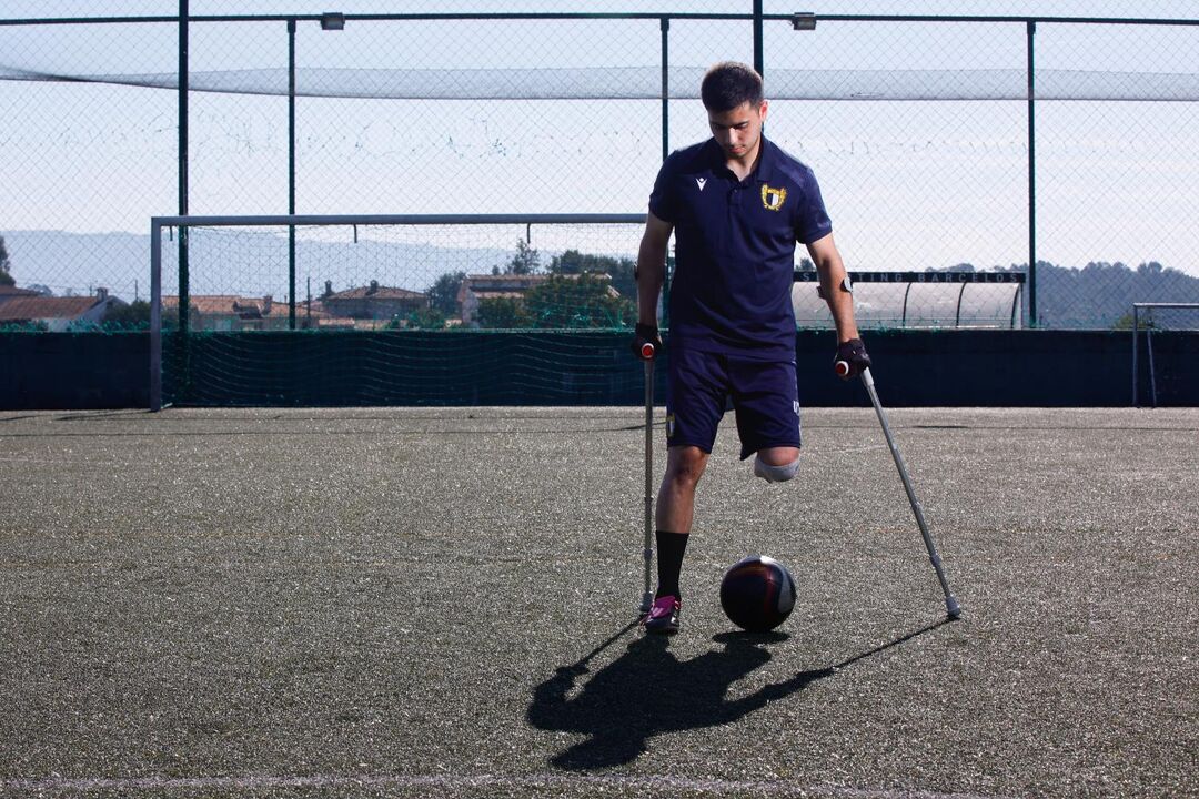 Miguel Barbosa encara a vida com resiliência após acidente.
