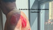 Rui Oliveira mostra ferimentos após queda na China