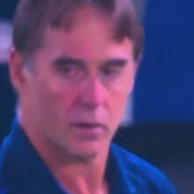 <![CDATA[ Lopetegui levou uma bolada em cheio e ficou com a cara neste estado ]]>