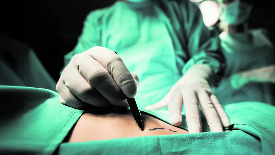 Cirurgia realizada em abril de 2019