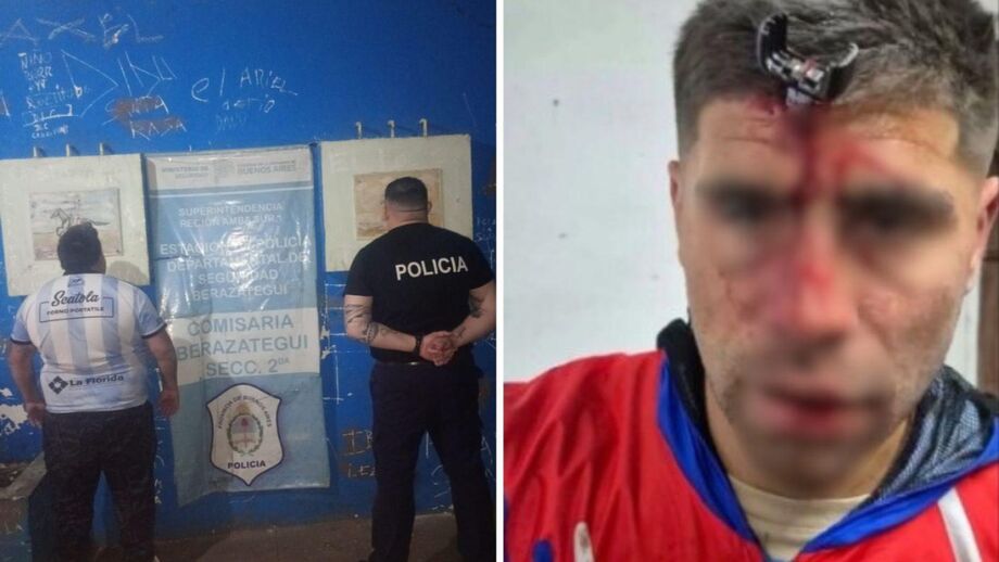 Tudo aconteceu enquanto assistia ao jogo da filha, em sub-16. Imagens podem chocar os leitores mais sensíveis