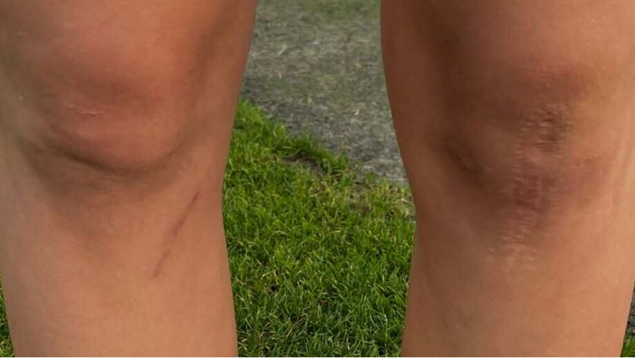 Sara Bermell, antiga jogadora do Marítimo, interrompe carreira aos 24 anos