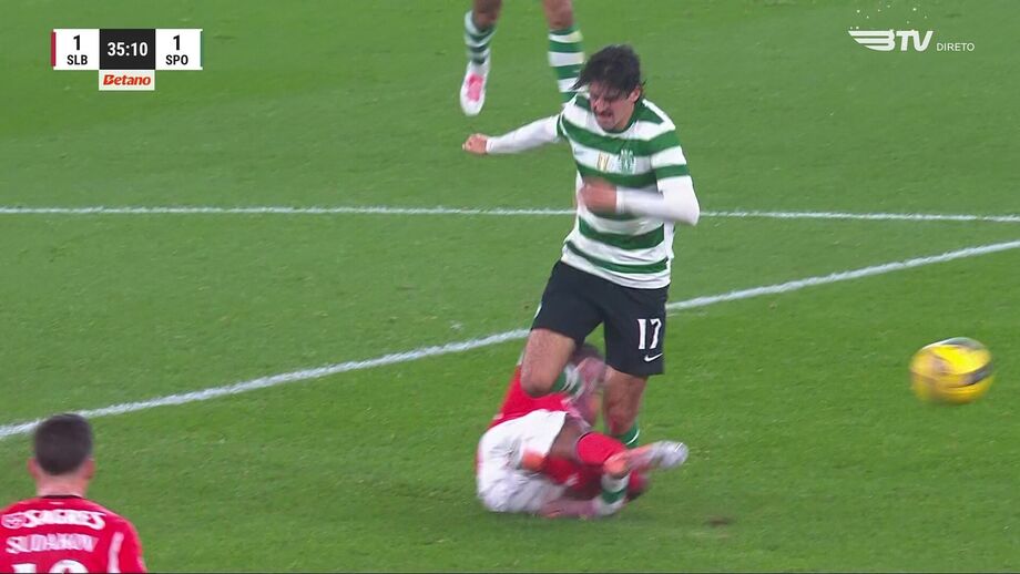 Trincão jogou no dérbi com entorse no tornozelo esquerdo sofrida aos 35 minutos