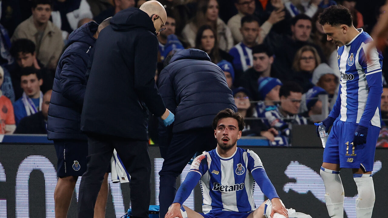 Martim Fernandes partiu o nariz no FC Porto-Benfica