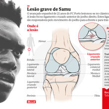 <![CDATA[ Lesão de Samu à lupa: afinal, o que faz o avançado do FC Porto terminar já a época? ]]>