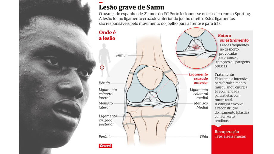 Lesão de Samu à lupa