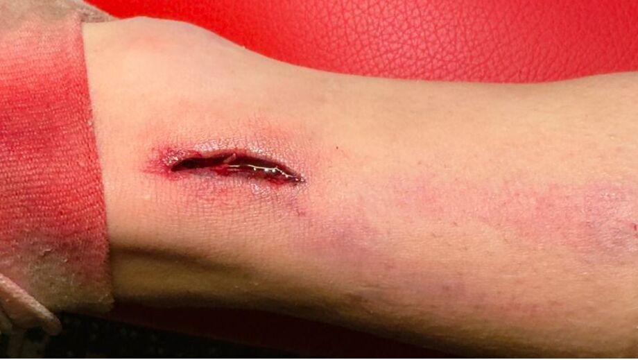 Tiago Dias leva pontos no tornozelo após jogo com Felgueiras