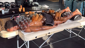 A recuperar baterias: Openda partilha imagens a realizar tratamento... peculiar