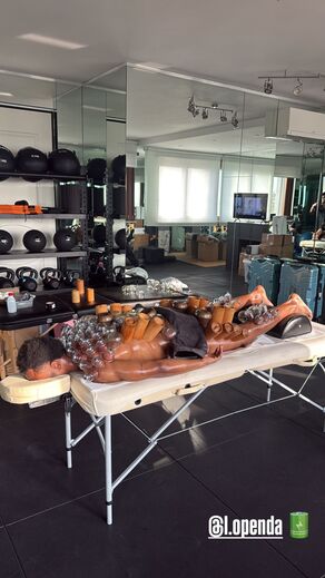 A recuperar baterias: Openda partilha imagens a realizar tratamento... peculiar