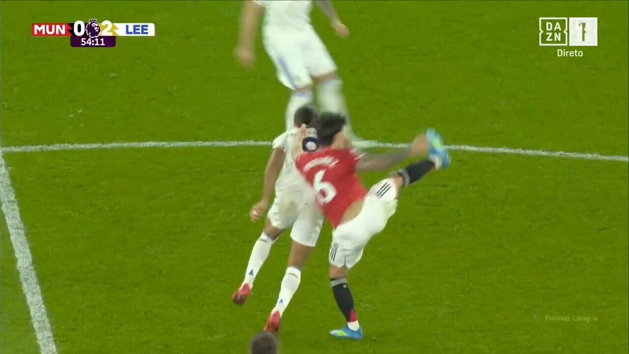 Lisandro Martínez expulso após puxar cabelo de Calvert-Lewin em jogo