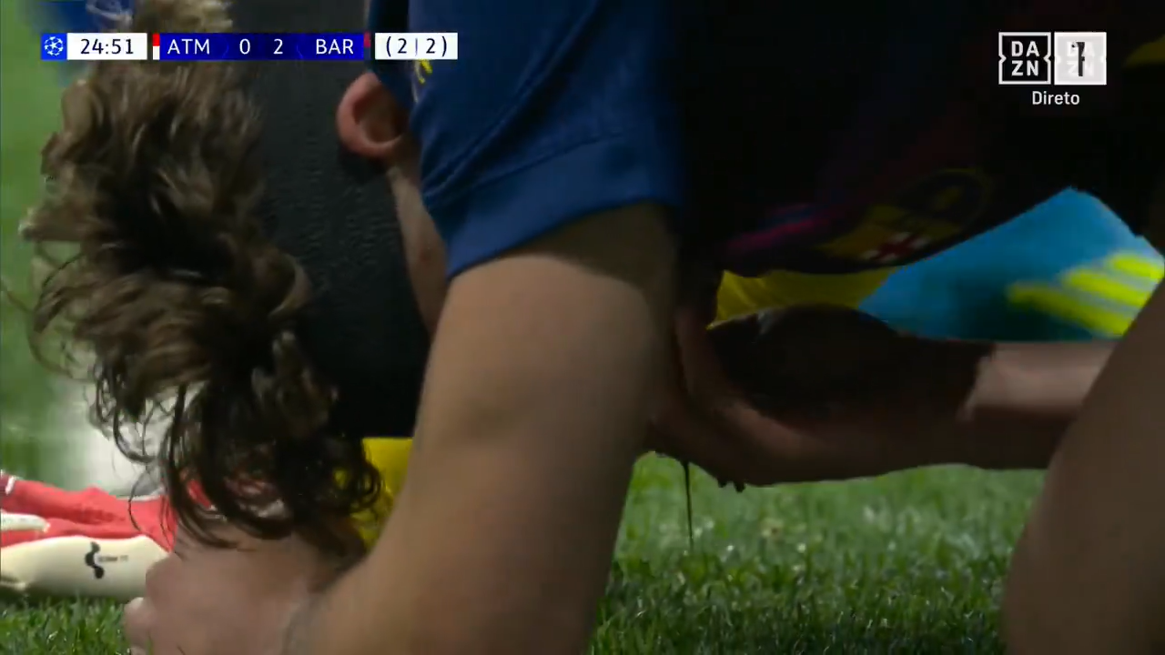 Fermín López sangra após choque com Musso no Atlético de Madrid vs Barcelona