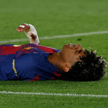 <![CDATA[ Lesão de Lamine Yamal preocupa: craque pode ter dito adeus à temporada e o Mundial... está à porta ]]>