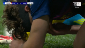 Fermín López sangra após choque com Musso no Atlético de Madrid vs Barcelona