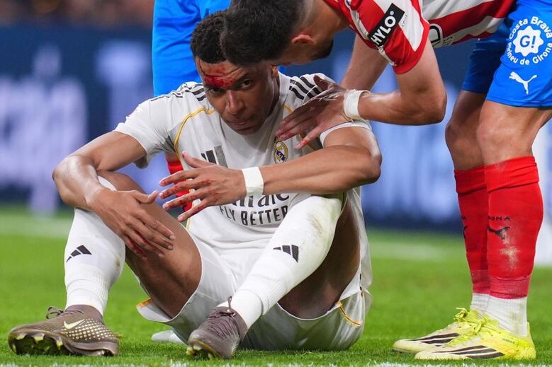 Mbappé com rosto ensanguentado após lance polémico no Real Madrid-Girona