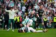 Daizen Maeda festeja o 2-1 para o Celtic marcado 87 minutos