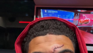 Gibbs-White