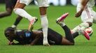 Koné com a perna fraturada