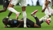 Koné com a perna fraturada