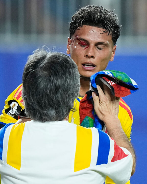 Richard Ríos visiblemente afectado tras la colisión en el partido Colombia-Ghana